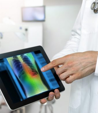 Disease Recurrence Prediction