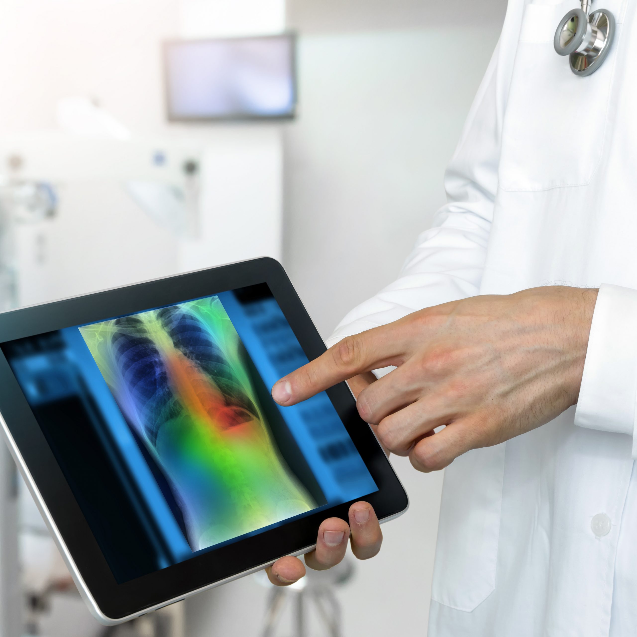 Disease Recurrence Prediction